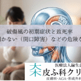 破傷風の初期症状と致死率｜口が開かない（開口障害）などの危険な痙攣