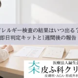 アレルギー検査の結果はいつ出る？｜即日判定キットと1週間後の報告