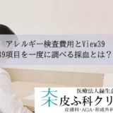 アレルギー検査費用とView39｜39項目を一度に調べる採血とは？