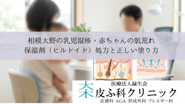 相模大野の乳児湿疹・赤ちゃんの肌荒れ｜保湿剤（ヒルドイド）処方と正しい塗り方