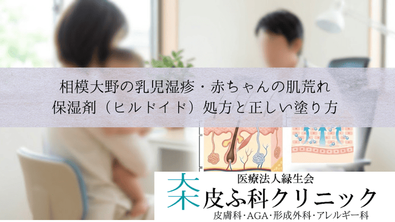 相模大野の乳児湿疹・赤ちゃんの肌荒れ|保湿剤(ヒルドイド)処方と正しい塗り方