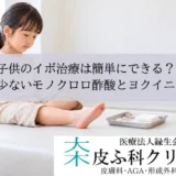 子供のイボ治療は簡単にできる？｜痛みの少ないモノクロロ酢酸とヨクイニン内服