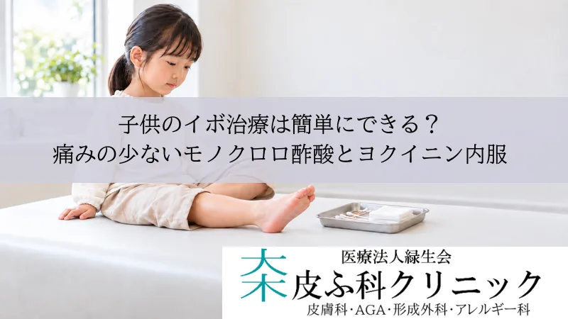 子供のイボ治療は簡単にできる?|痛みの少ないモノクロロ酢酸とヨクイニン内服