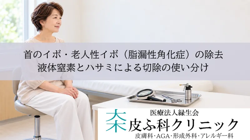 首のイボ・老人性イボ(脂漏性角化症)の除去|液体窒素とハサミによる切除の使い分け