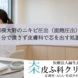 相模大野のニキビ圧出（面皰圧出）｜自分で潰さず皮膚科で芯を出す処置