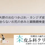 相模大野のおむつかぶれ・カンジダ皮膚炎｜治らないお尻の赤みと顕微鏡検査