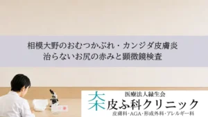 相模大野のおむつかぶれ・カンジダ皮膚炎｜治らないお尻の赤みと顕微鏡検査