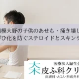 相模大野の子供のあせも・掻き壊し｜とびひ化を防ぐステロイドとスキンケア
