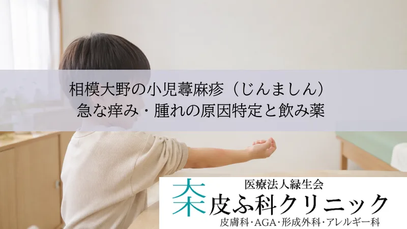相模大野の小児蕁麻疹（じんましん）｜急な痒み・腫れの原因特定と飲み薬