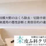 相模大野のほくろ除去・切除手術｜保険適用の悪性診断と美容目的の違い