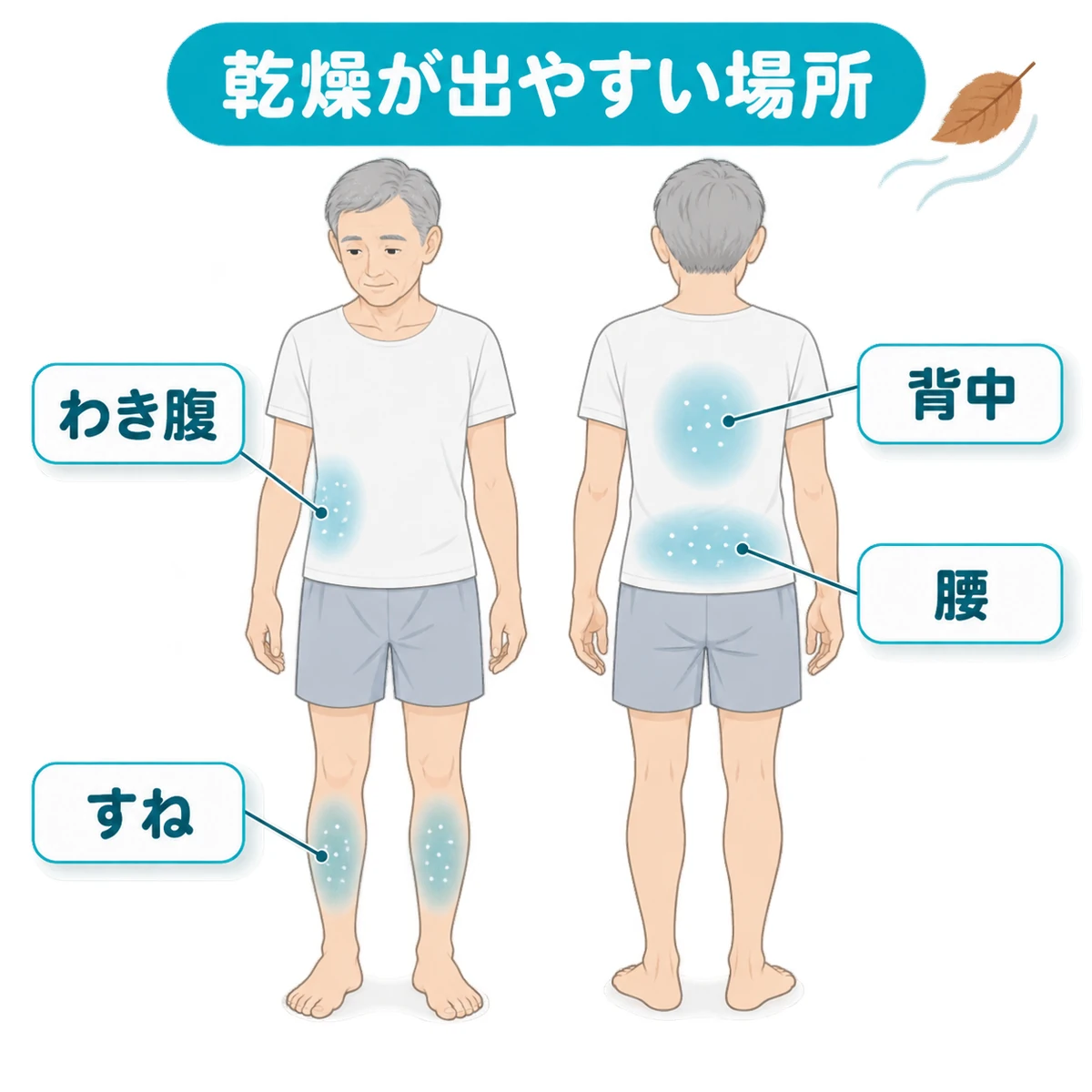 高齢男性の正面と背面に、乾燥しやすいすね・わき腹・背中・腰の位置を示した図