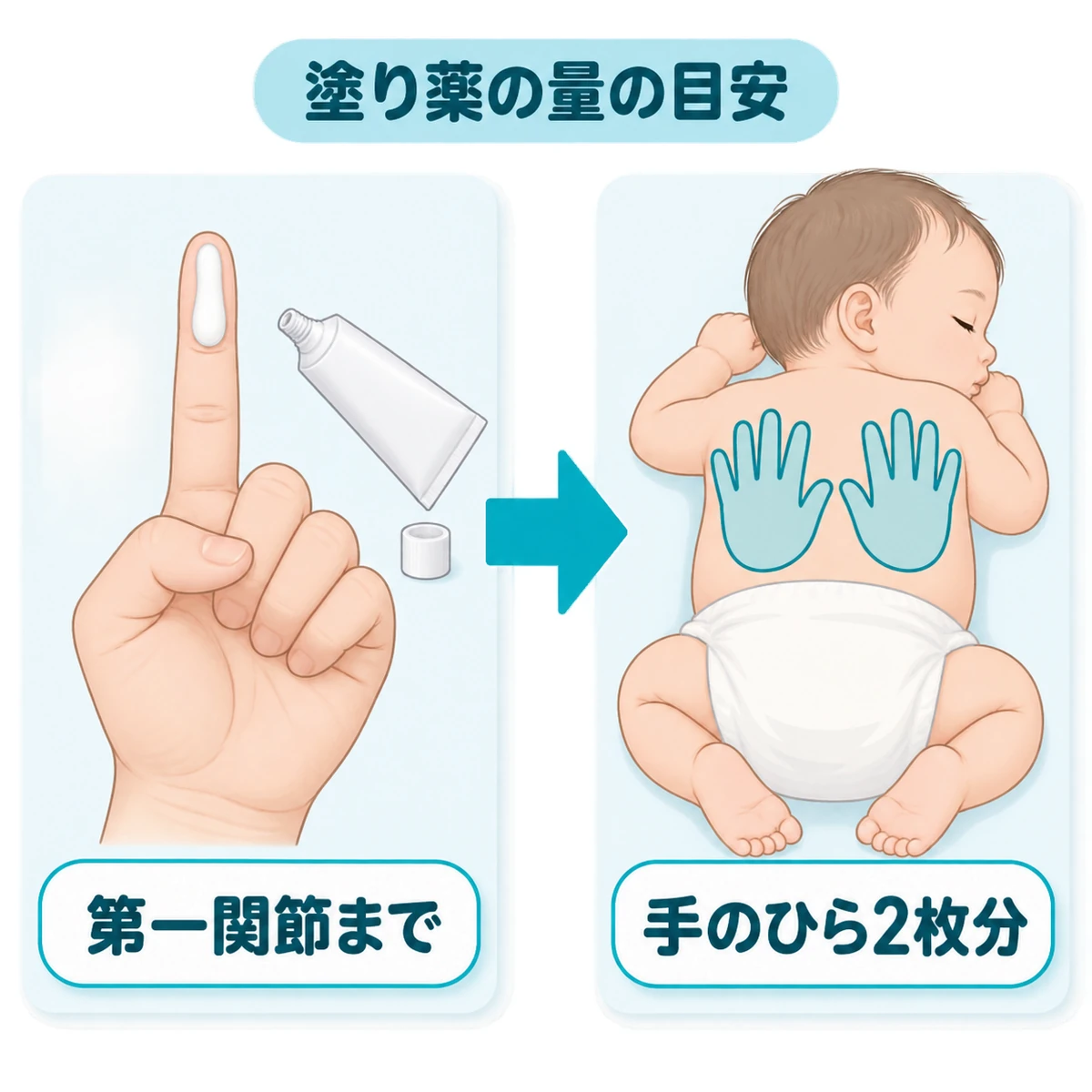 人差し指の先から第一関節までの塗り薬が、赤ちゃんの背中で大人の手のひら2枚分に相当する目安を表した図