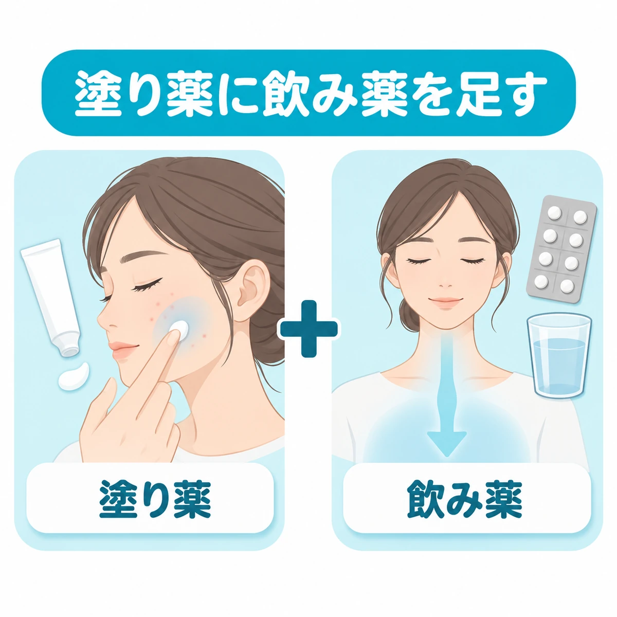 塗り薬による外側からの治療と、飲み薬による体の内側からの治療を組み合わせる図